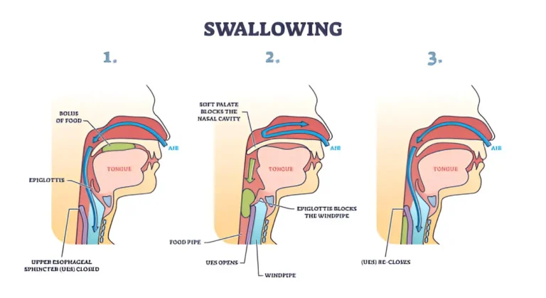 Understanding Swallowing Disorders: Causes and Management Techniques